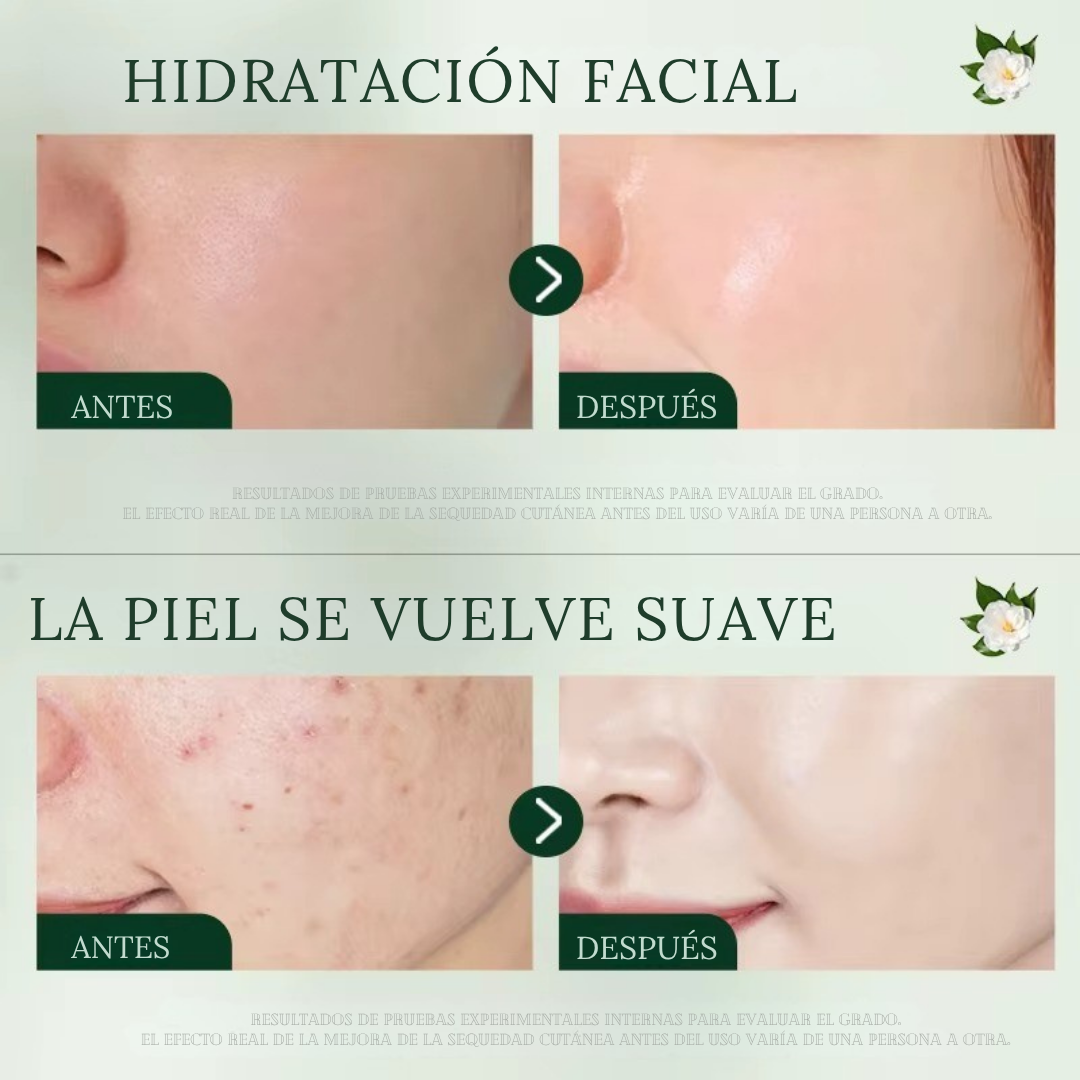 Crema Facial Antiacné con Aceite de Árbol de Té 50ml - SADOER (OFERTA 2x1)